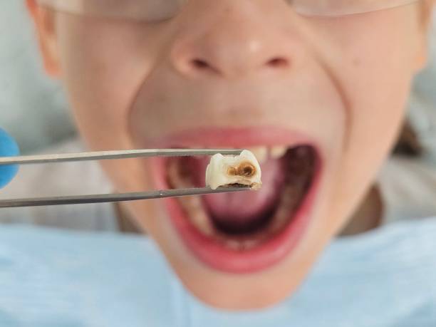 Best Emergency Dental Care for Trauma or Injury in Lavalette, WV